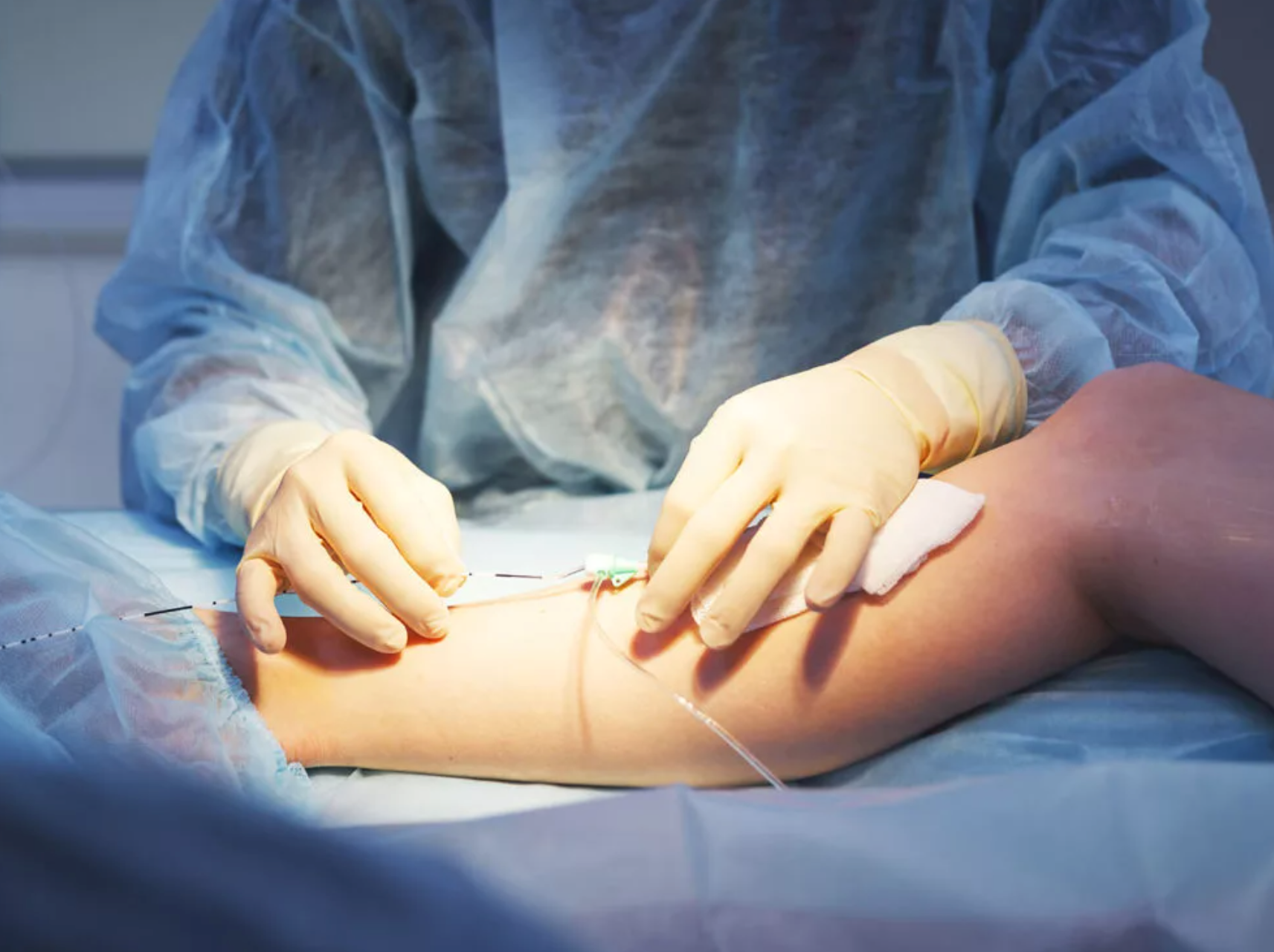 Стоимость операции по удалению варикоза