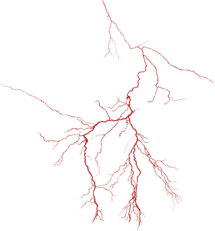 Выпуклые височные вены: проблема удаления