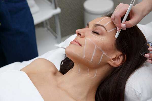 Осложнения после нитевого лифтинга