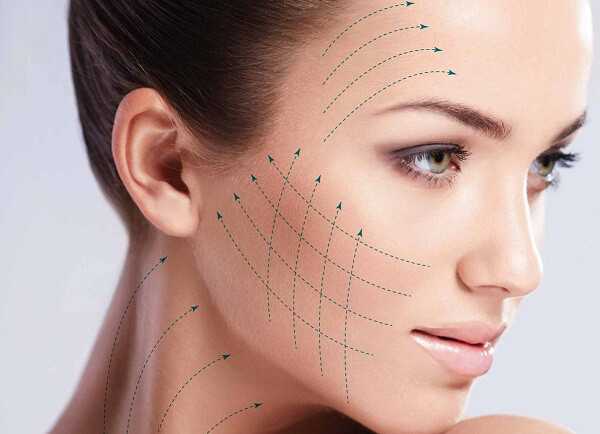 Эффект нитевого лифтинга