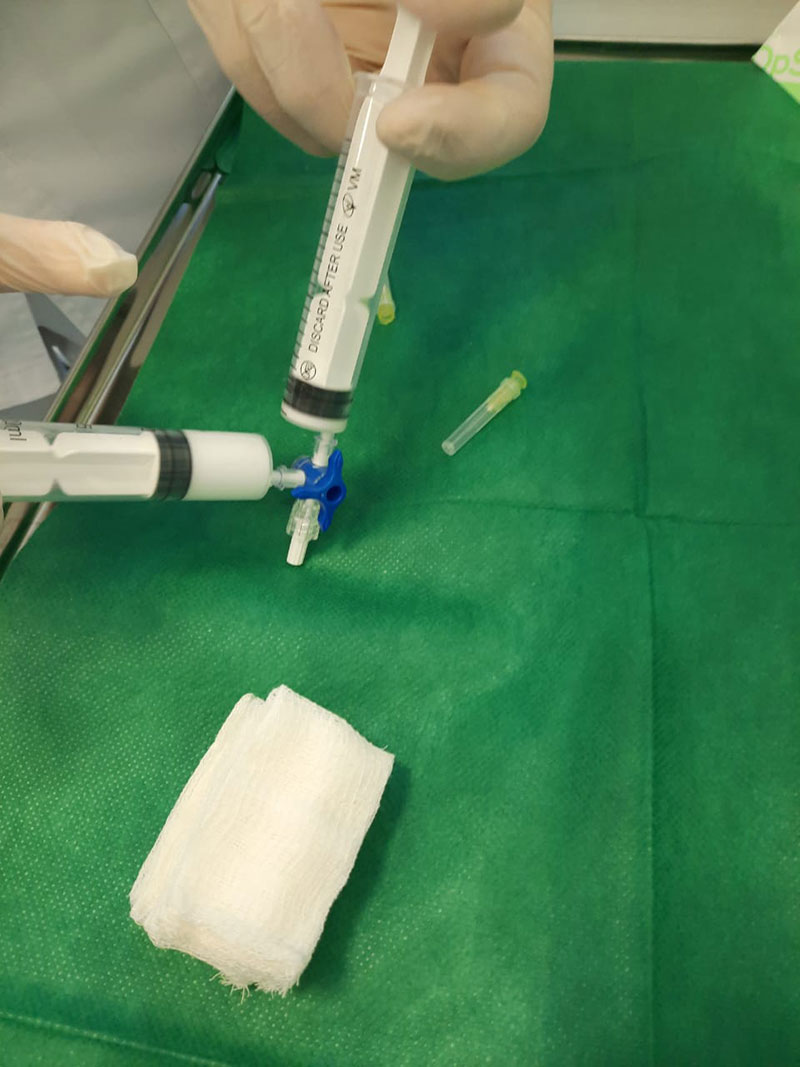 Предоперационная подготовка