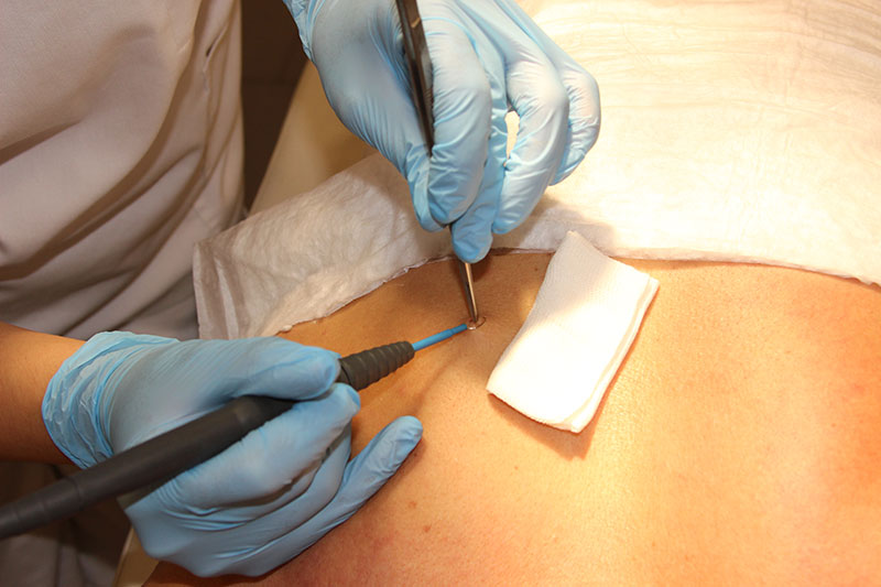 Подготовка