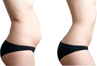 ЧТО ВЫ ПОЛУЧИТЕ В РЕЗУЛЬТАТЕ ЛЕЧЕНИЯ ВОЗРАСТНЫХ ИЗМЕНЕНИЙ