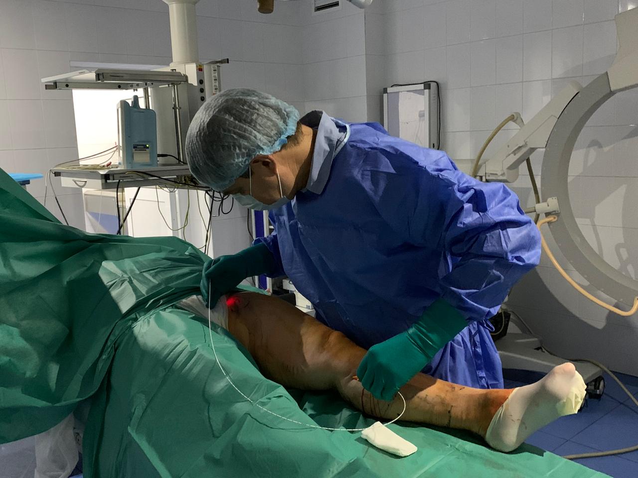 Лазерная операция при варикозе