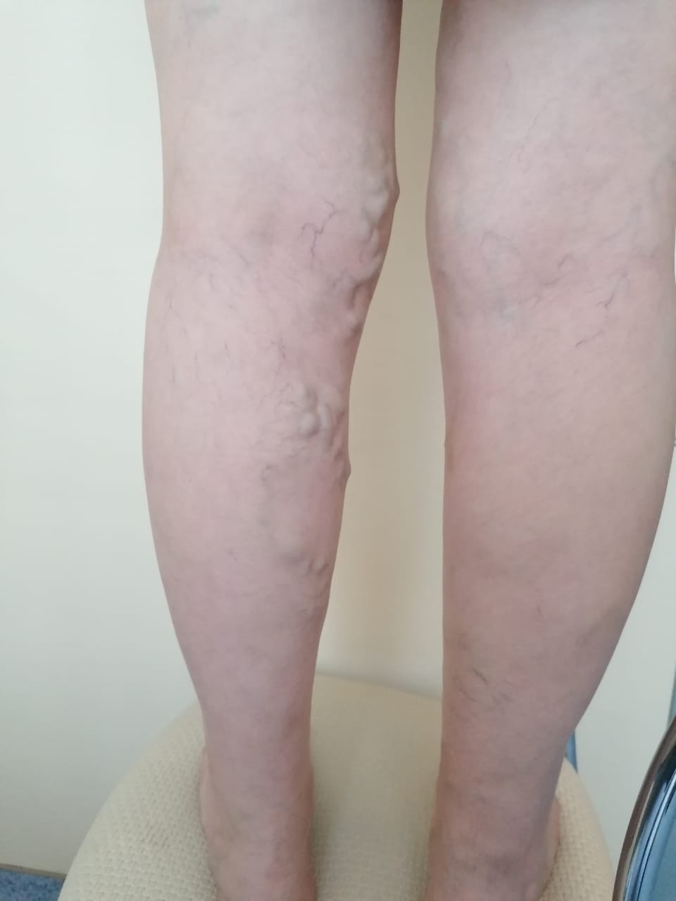 Подготовка к приему