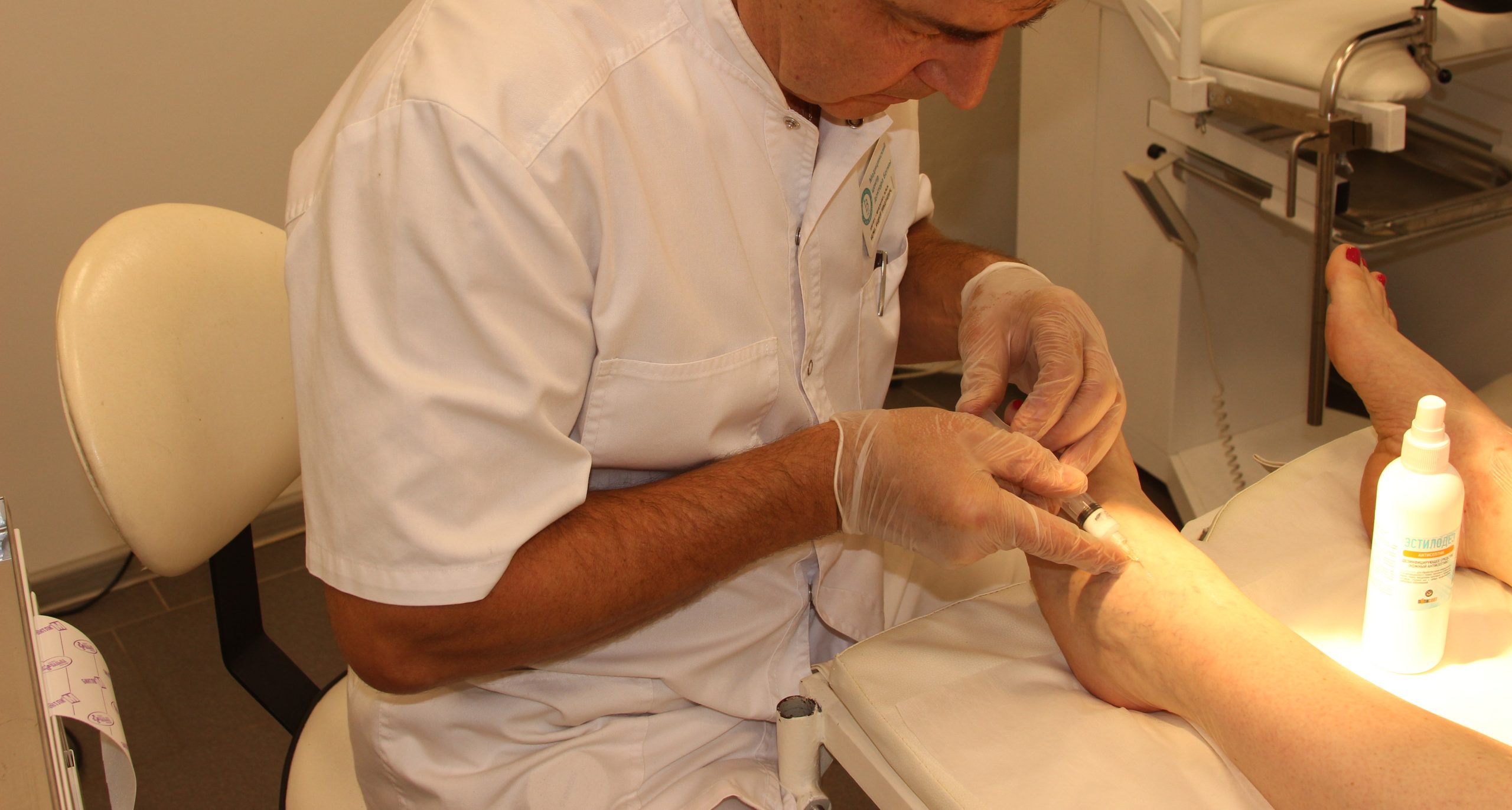 Показания к пенной склеротерапии