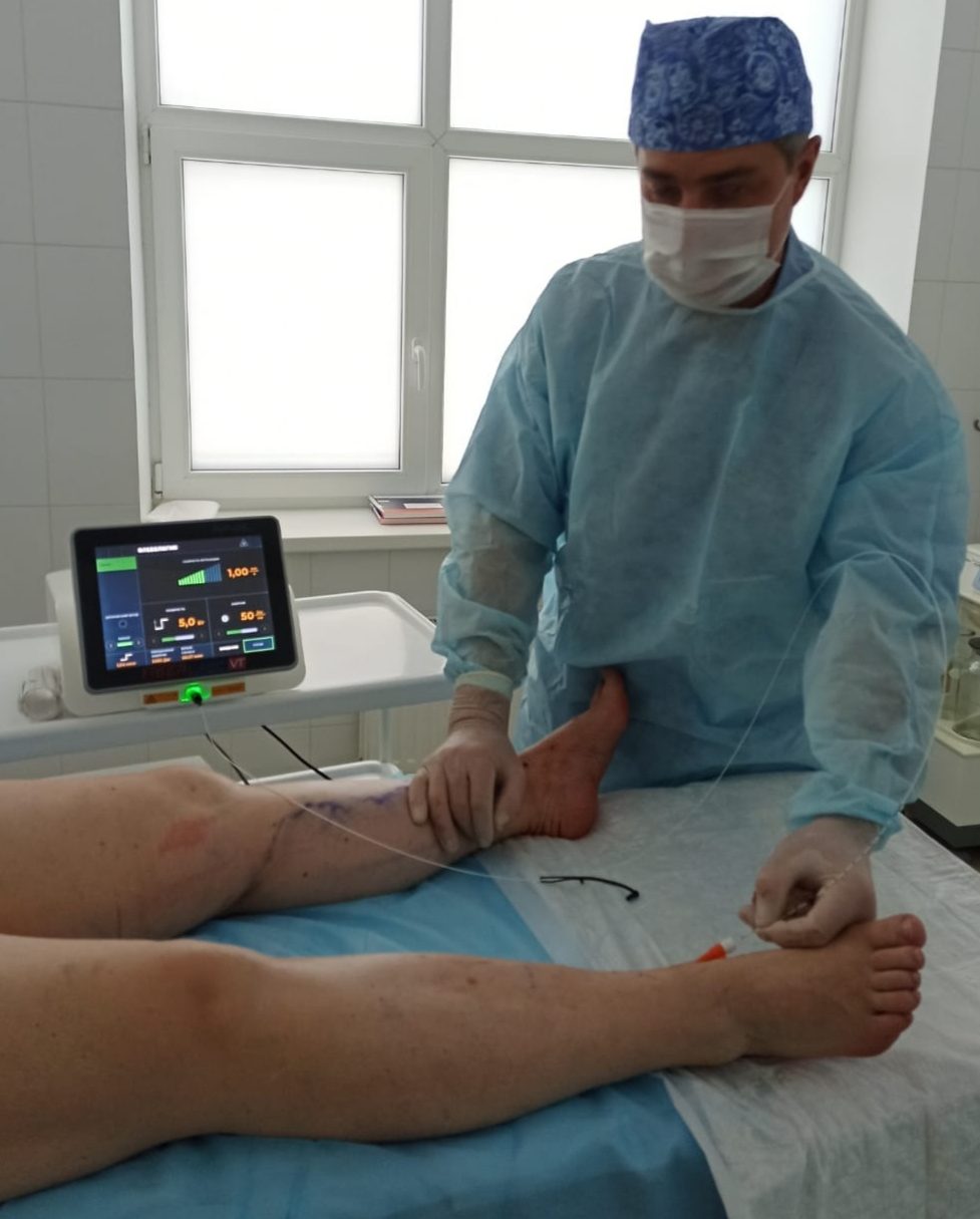 Консультация врача-флеболога в медицинском центре доктора Бегмы