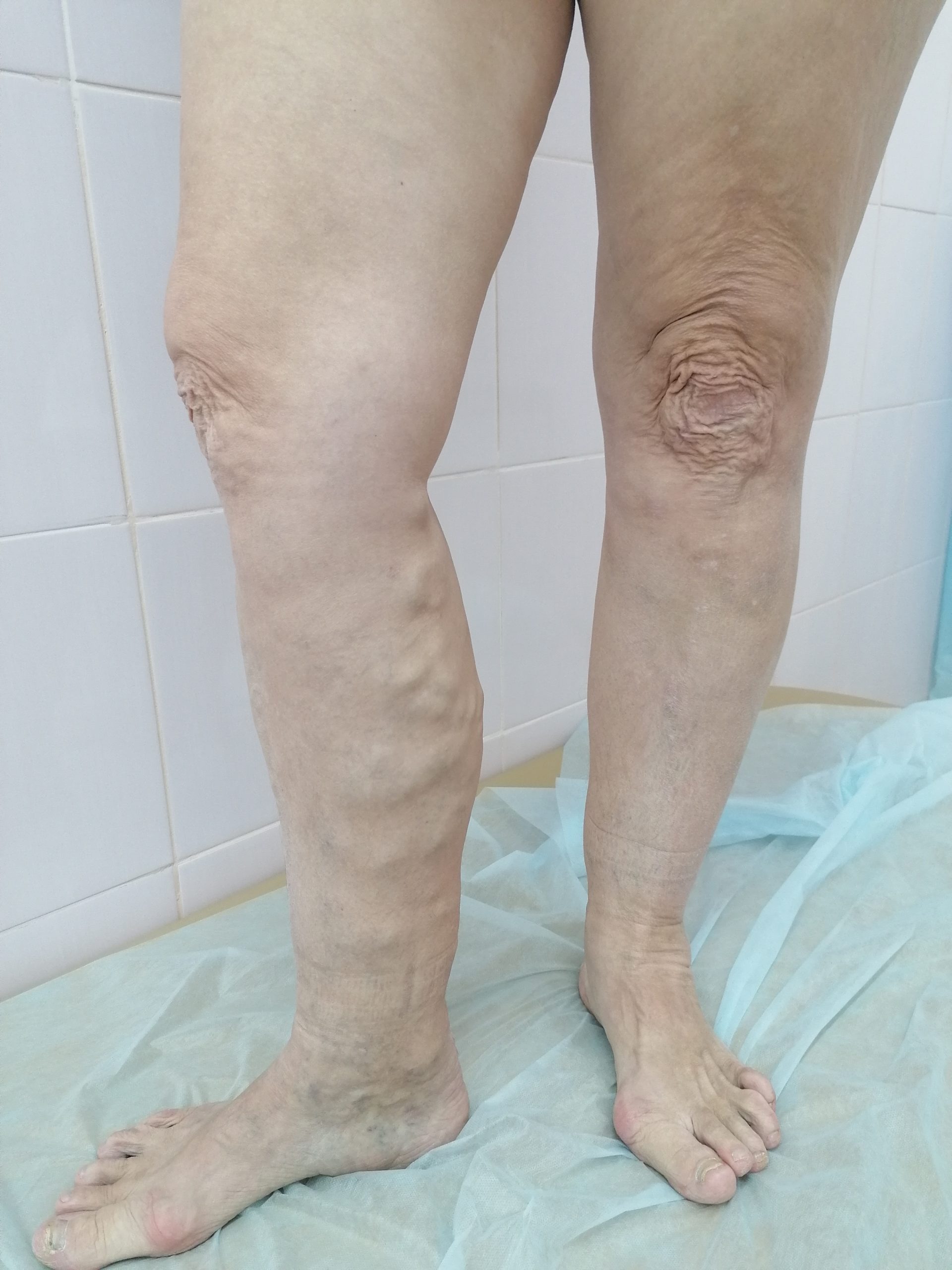 Подготовка к приему