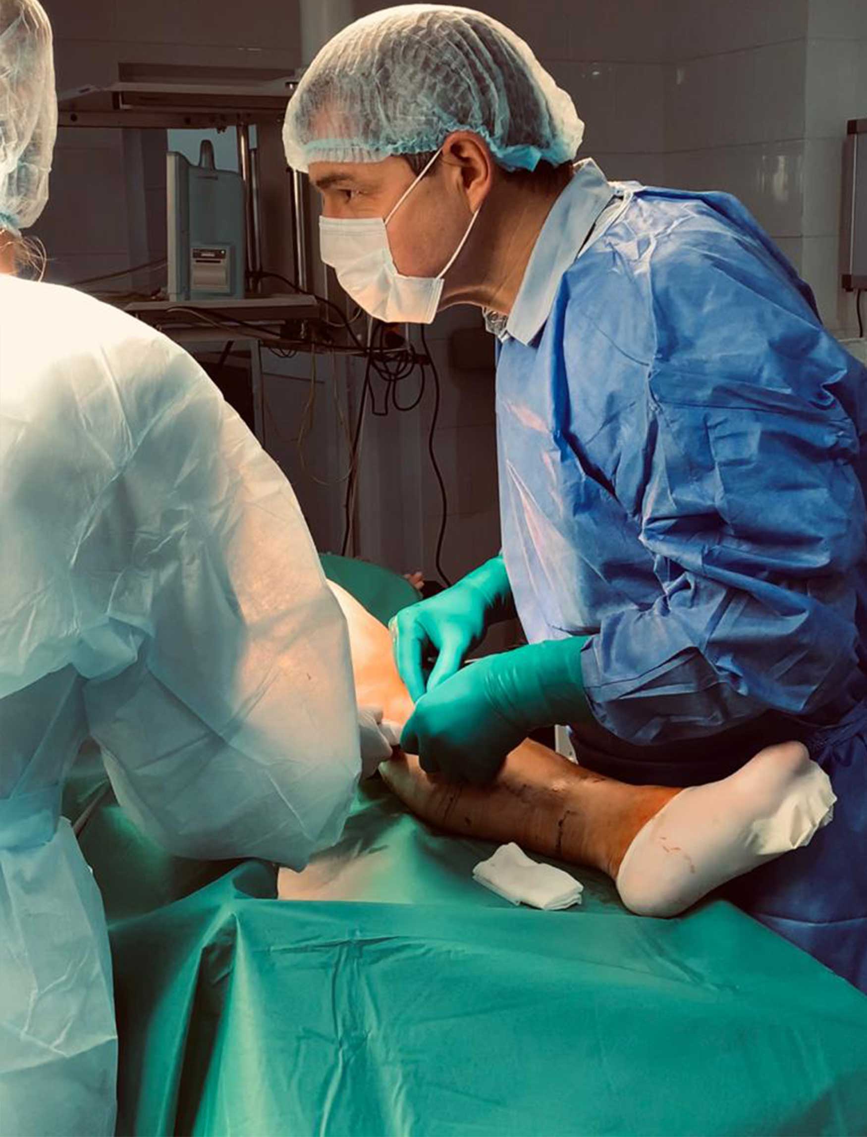 Преимущества флебэктомии