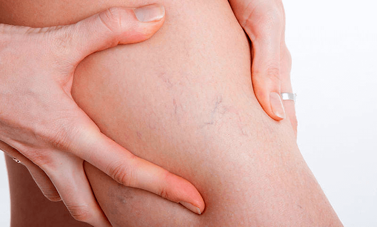 Проведение