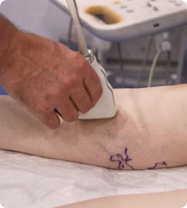 ОСОБЕННОСТИ ОСНАЩЕНИЯ ФЛЕБОЛОГИЧЕСКОГО ОТДЕЛЕНИЯ МЕДИЦИНСКОГО ЦЕНТРА ДОКТОРА БЕГМЫ-1