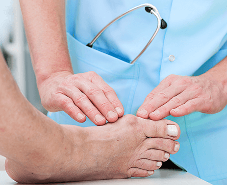 СИМПТОМЫ ВАЛЬГУСНОЙ ДЕФОРМАЦИИ