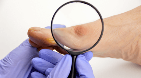 КАК ПРОХОДИТ ХИРУРГИЧЕСКОЕ ВМЕШАТЕЛЬСТВО И ЕГО ПОДГОТОВКА