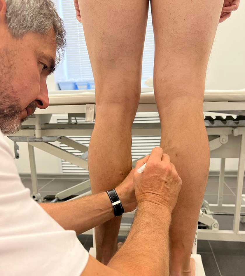 Консервативное лечение