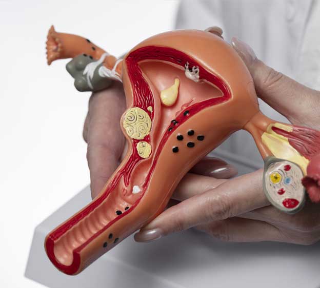 Образования яичников