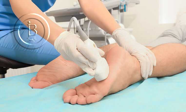 Сравнение вариантов лечения синдрома диабетической стопы