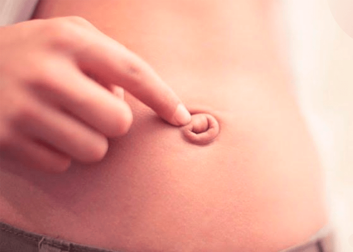 Операции при пупочных грыжах