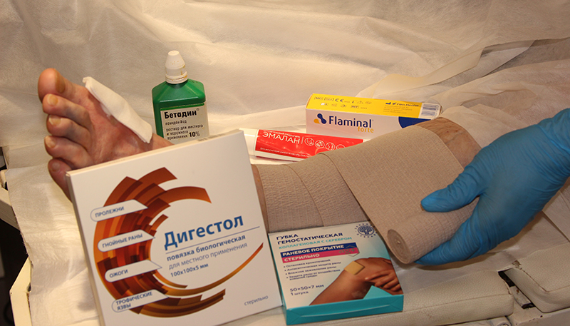 Мази и растворы для местного лечения трофических язв
