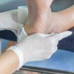 Хирургическое вмешательство при диабетической стопе