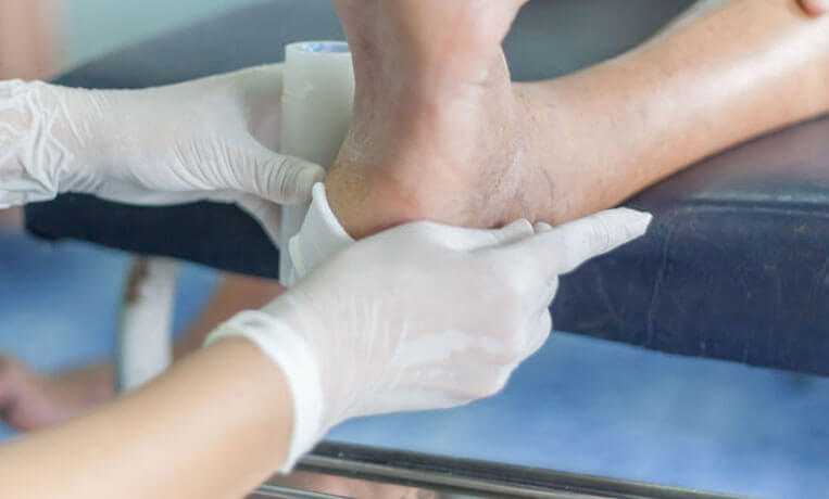 Хирургическое вмешательство при диабетической стопе