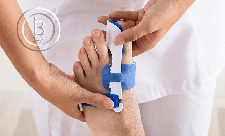 Лечение деформации стопы без операции