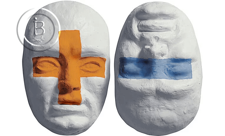 Плюсы и минусы нитевого лифтинга