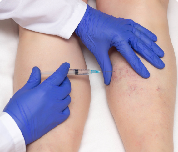 ПРОБЛЕМЫ С СОСУДАМИ СИМПТОМЫ И ВОЗМОЖНЫЕ ЗАБОЛЕВАНИЯ ВЕН