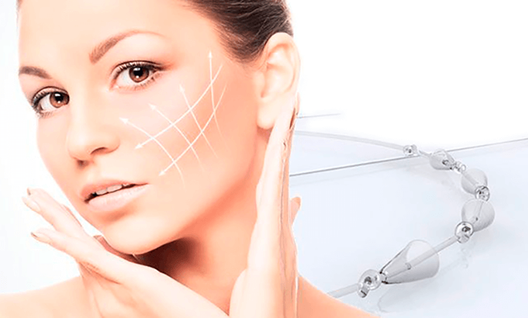 Виды нитей для лифтинга