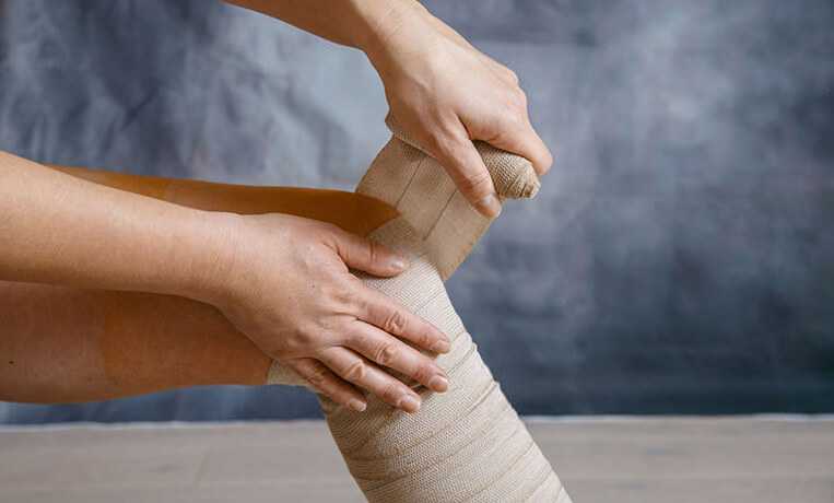 Эластичный бинт при варикозе как подобрать и как бинтовать?