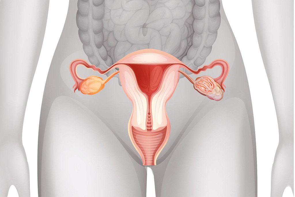 Эрозия, эктопия шейки матки