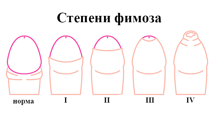 ЭТАПЫ ЛЕЧЕНИЯ