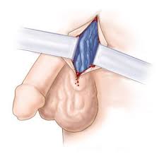 СИМПТОМЫ ПАТОЛОГИИ