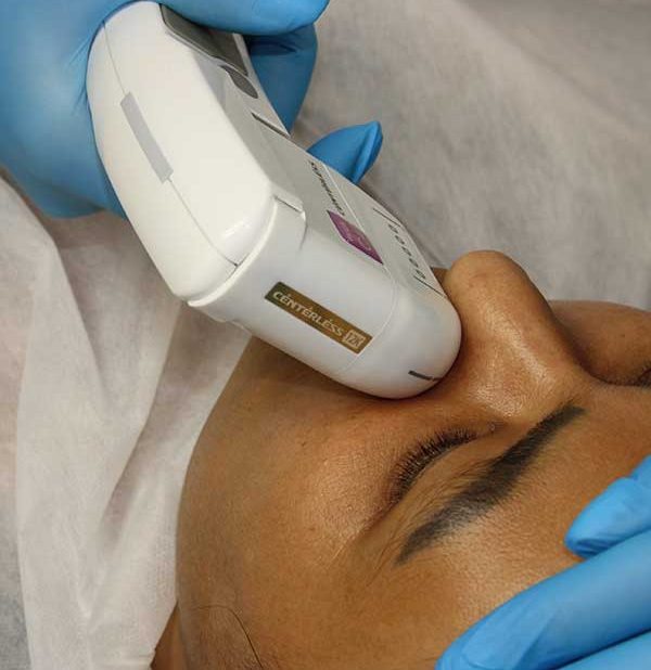 Преимущества SMAS-лифтинга