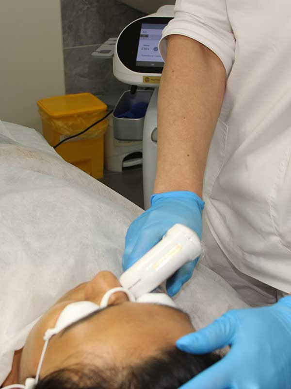 Восстановление