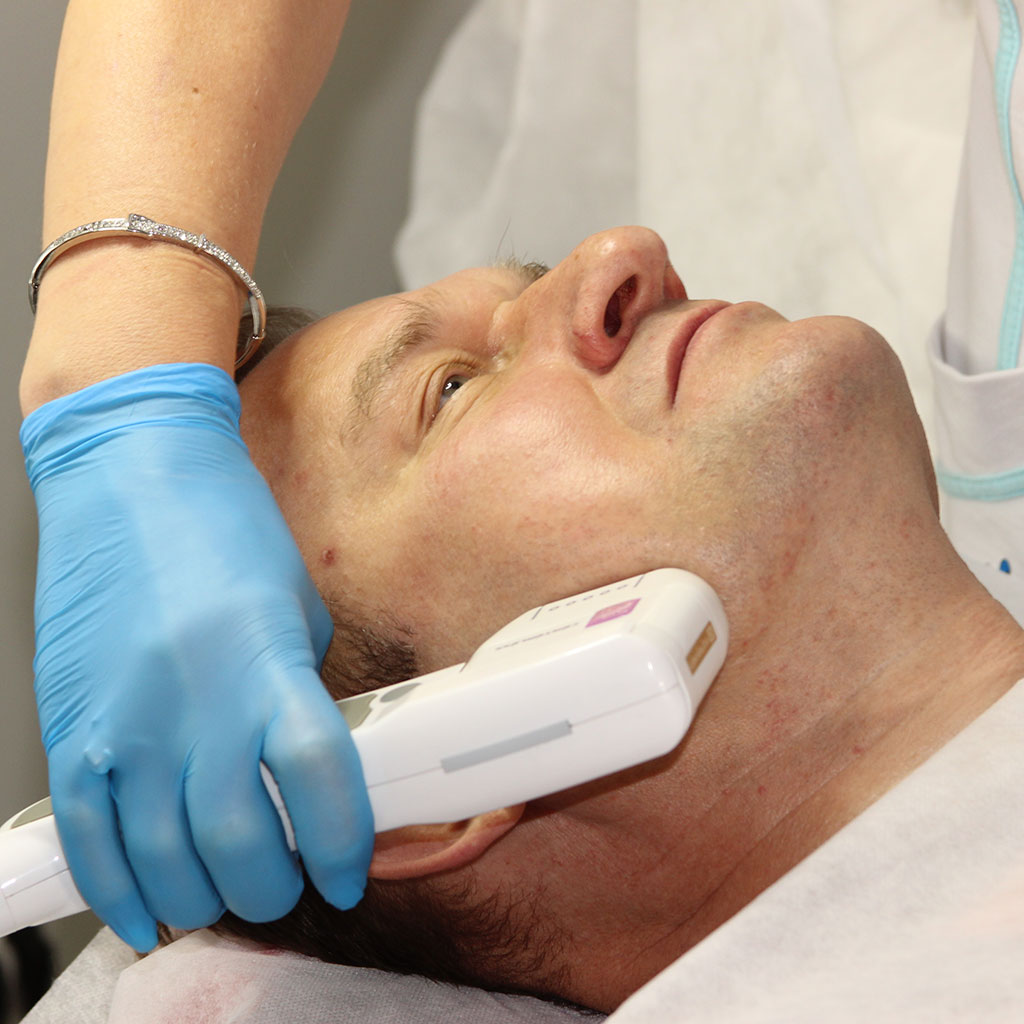 SMAS-лифтинг нижней трети лица