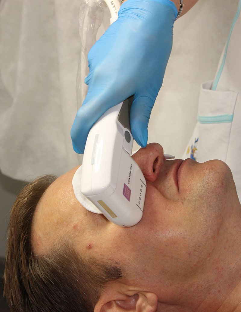 SMAS-лифтинг век и зоны вокруг глаз SMAS-лифтинг век и зоны вокруг глаз