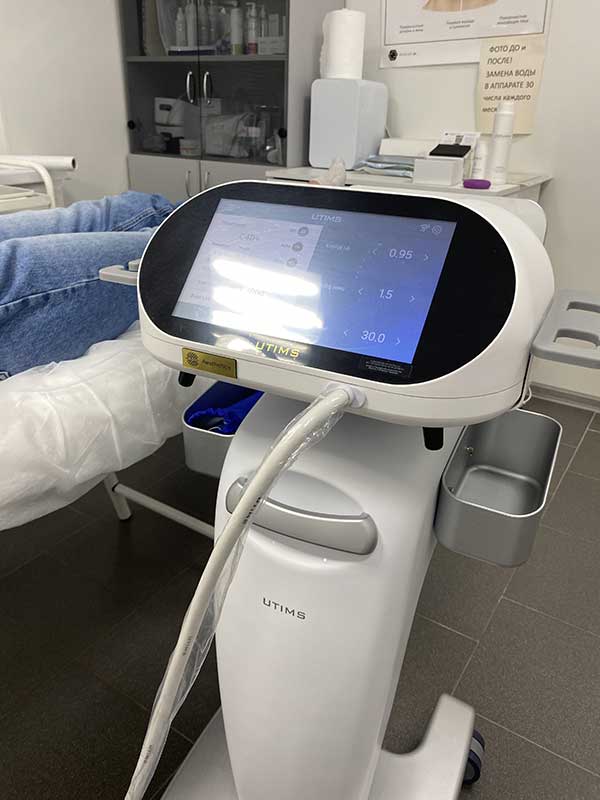 Показания к SMAS-лифтингу зоны декольте