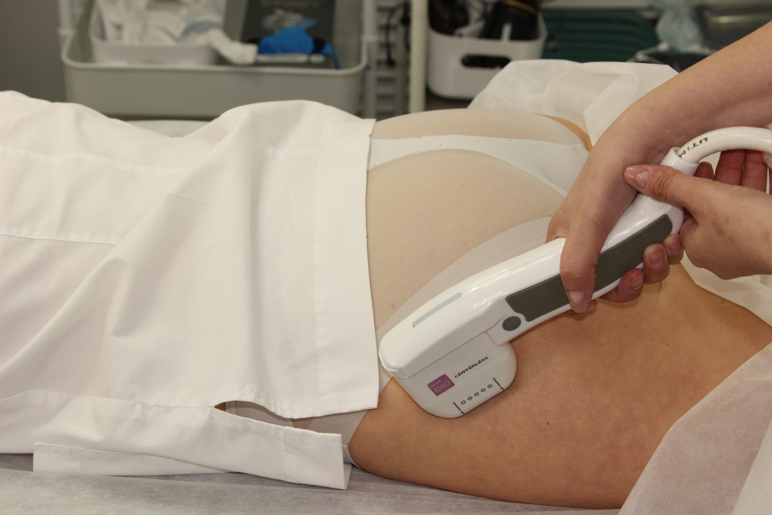 Для каких зон эффективен SMAS-лифтинг