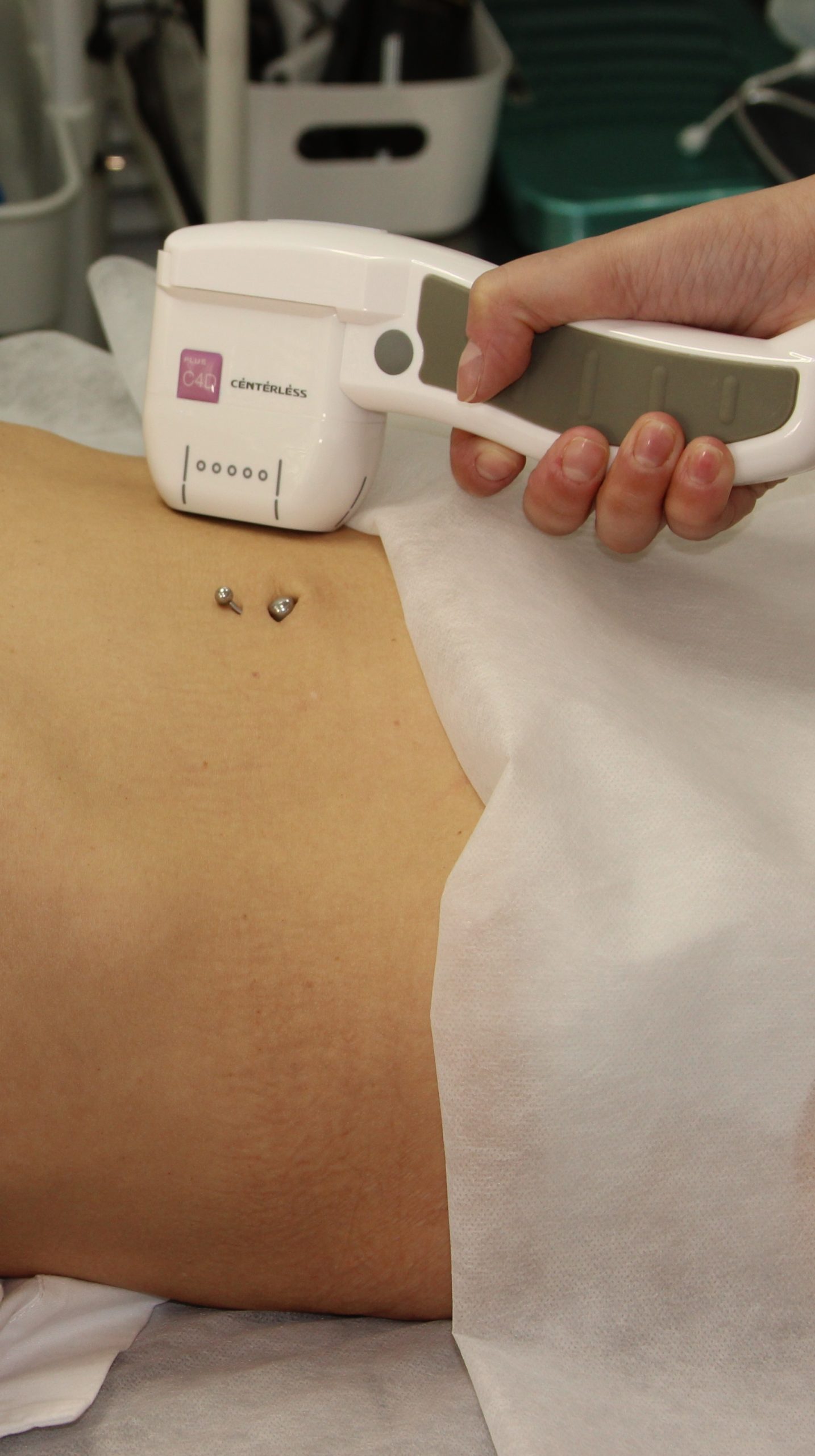 SMAS-лифтинг интимной зоны