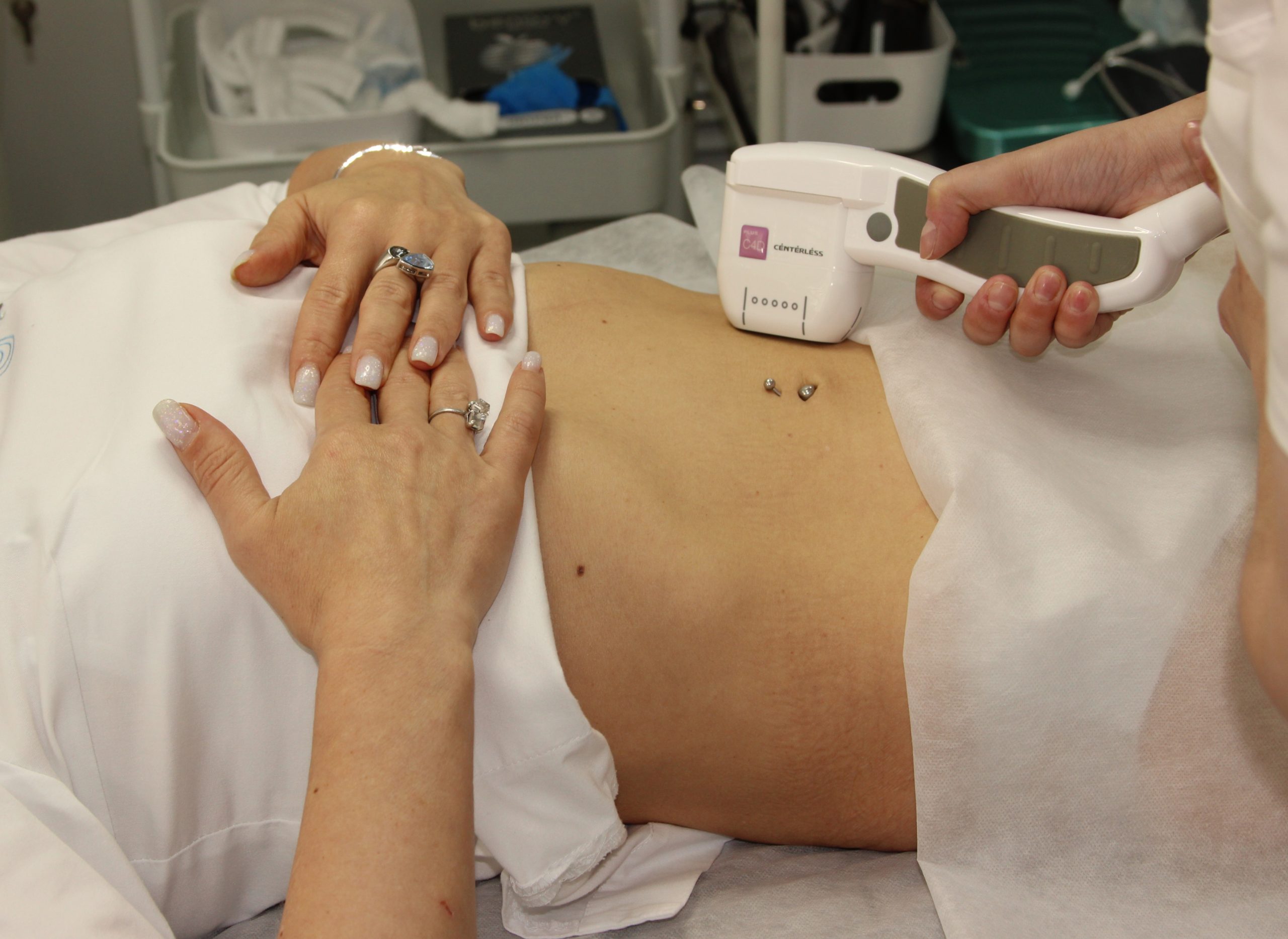 Преимущества SMAS-лифтинга