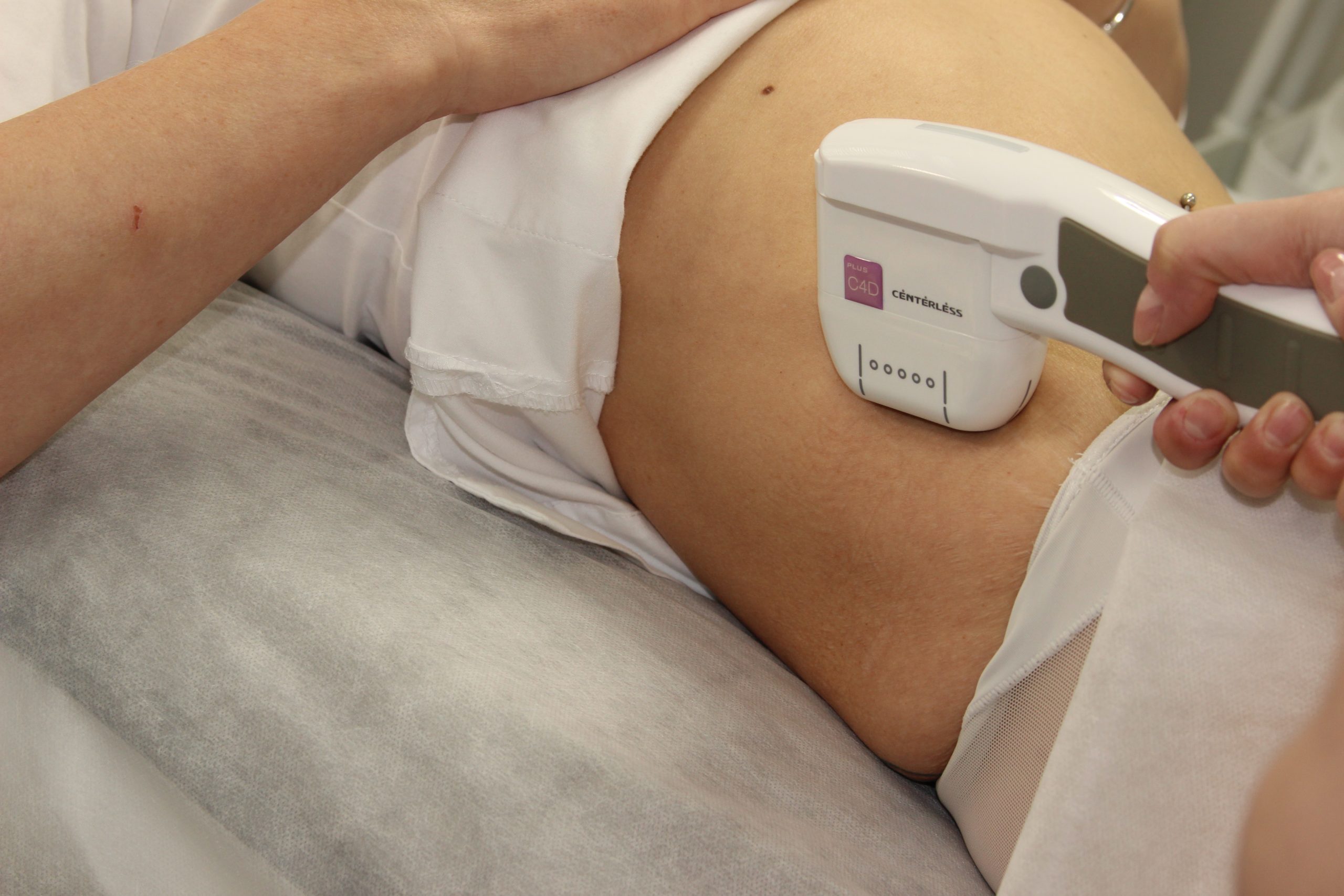 SMAS-лифтинг тела в клинике Бегмы