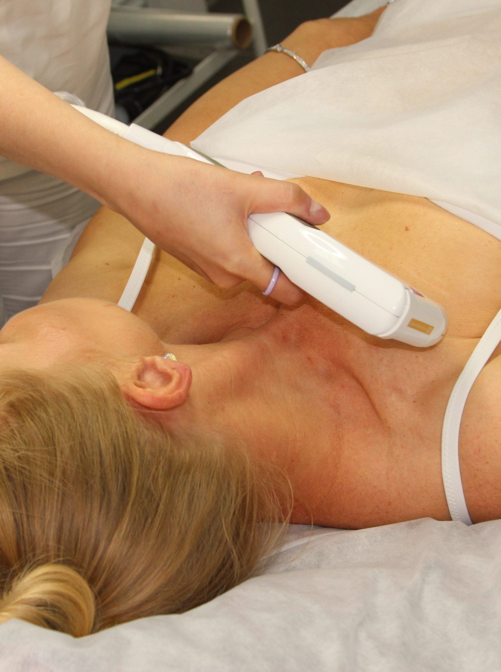 SMAS-лифтинг груди