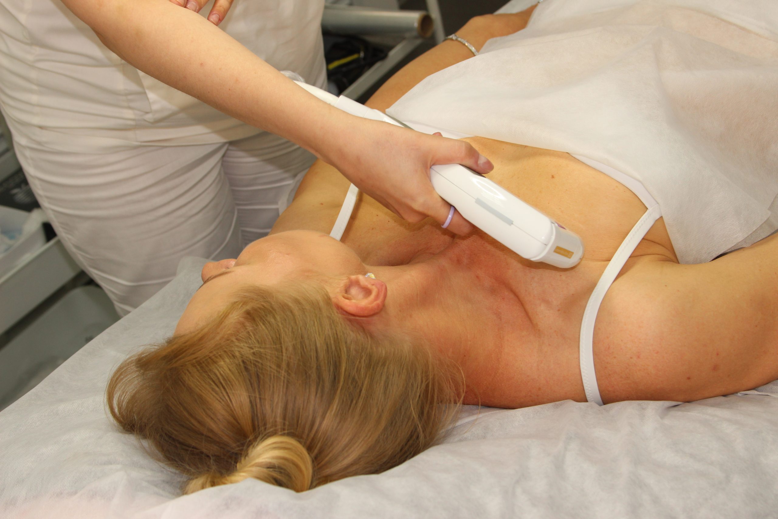 Эффект от SMAS-лифтинга