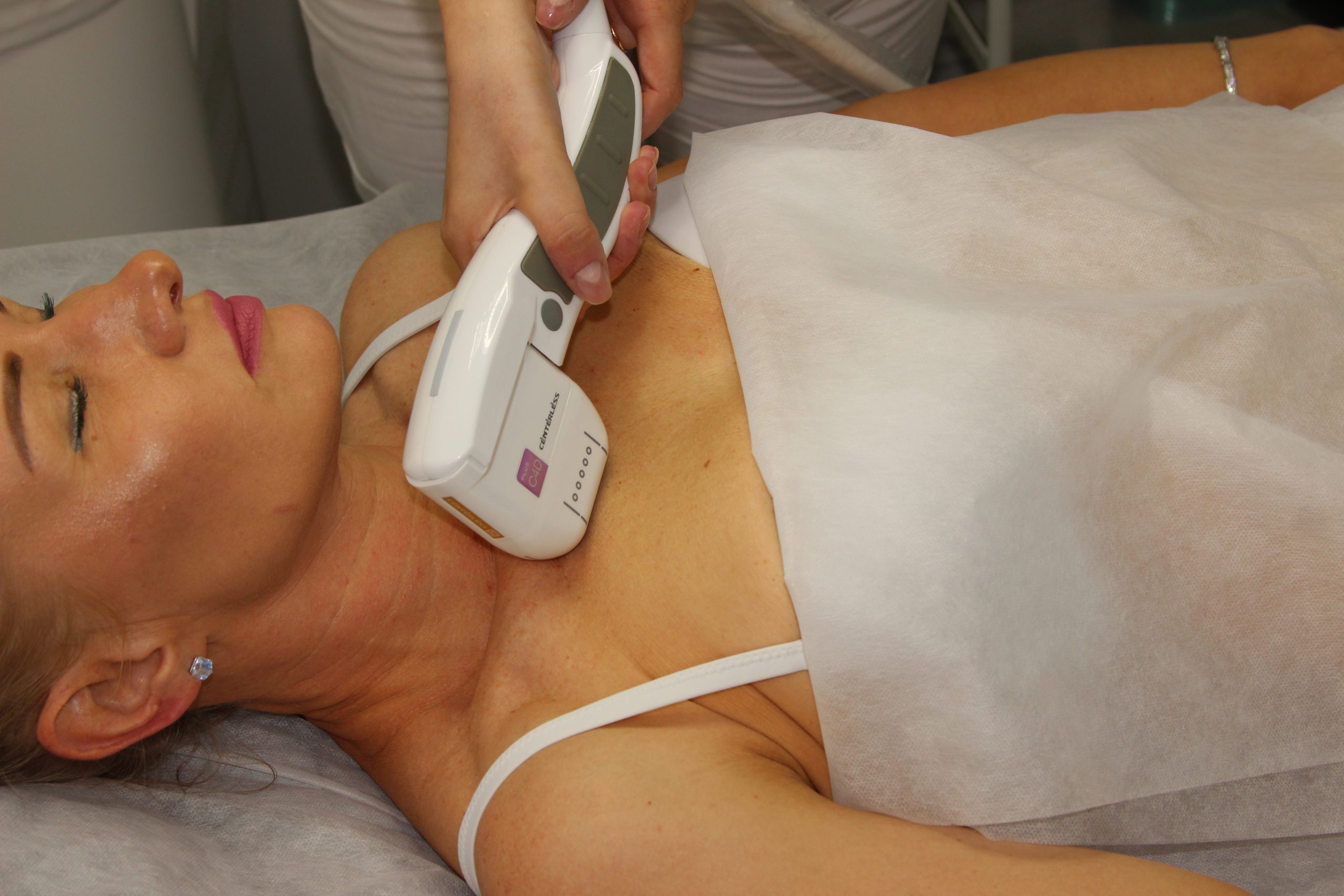 Зоны SMAS-подтяжки тела