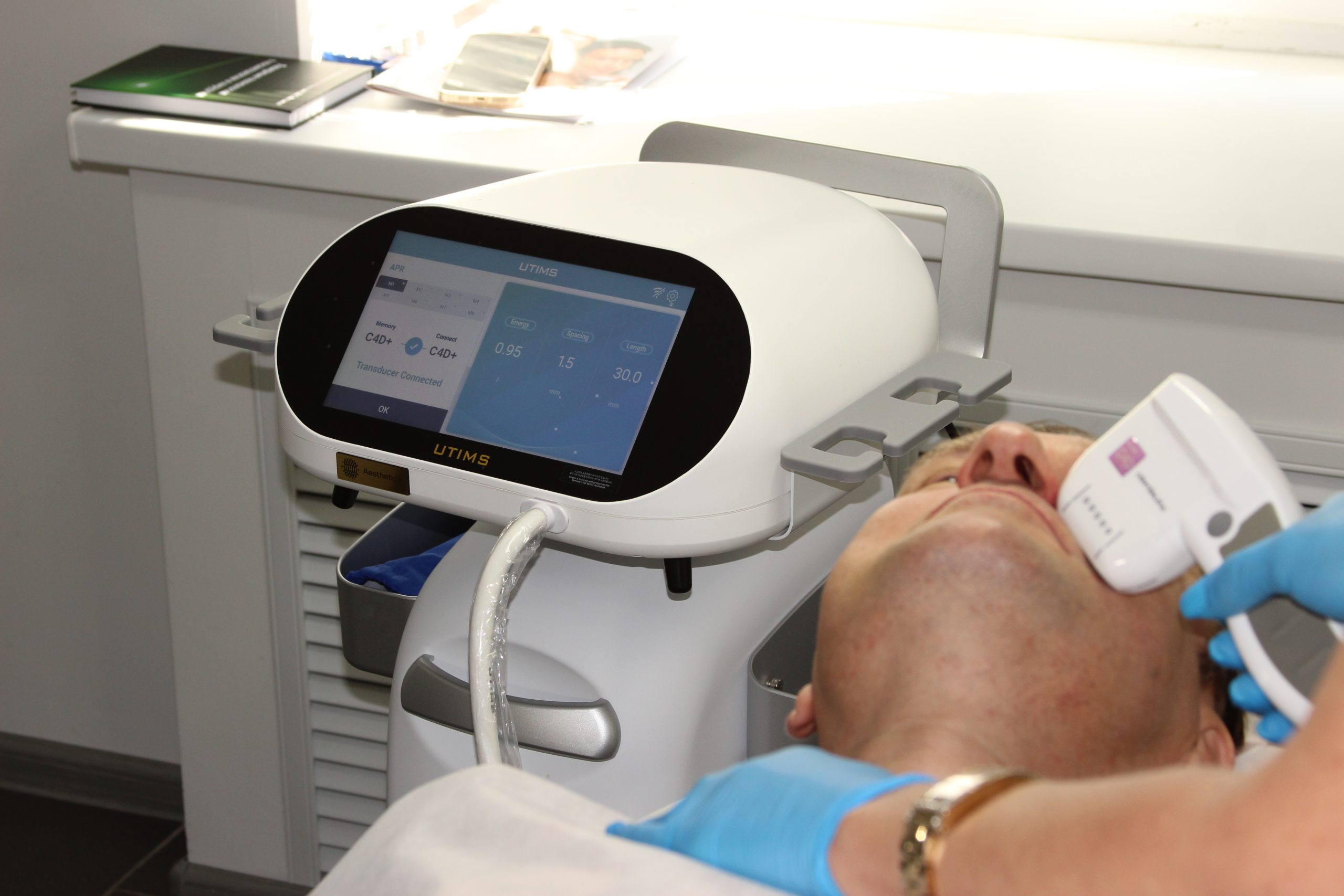 Преимущества SMAS-лифтинга