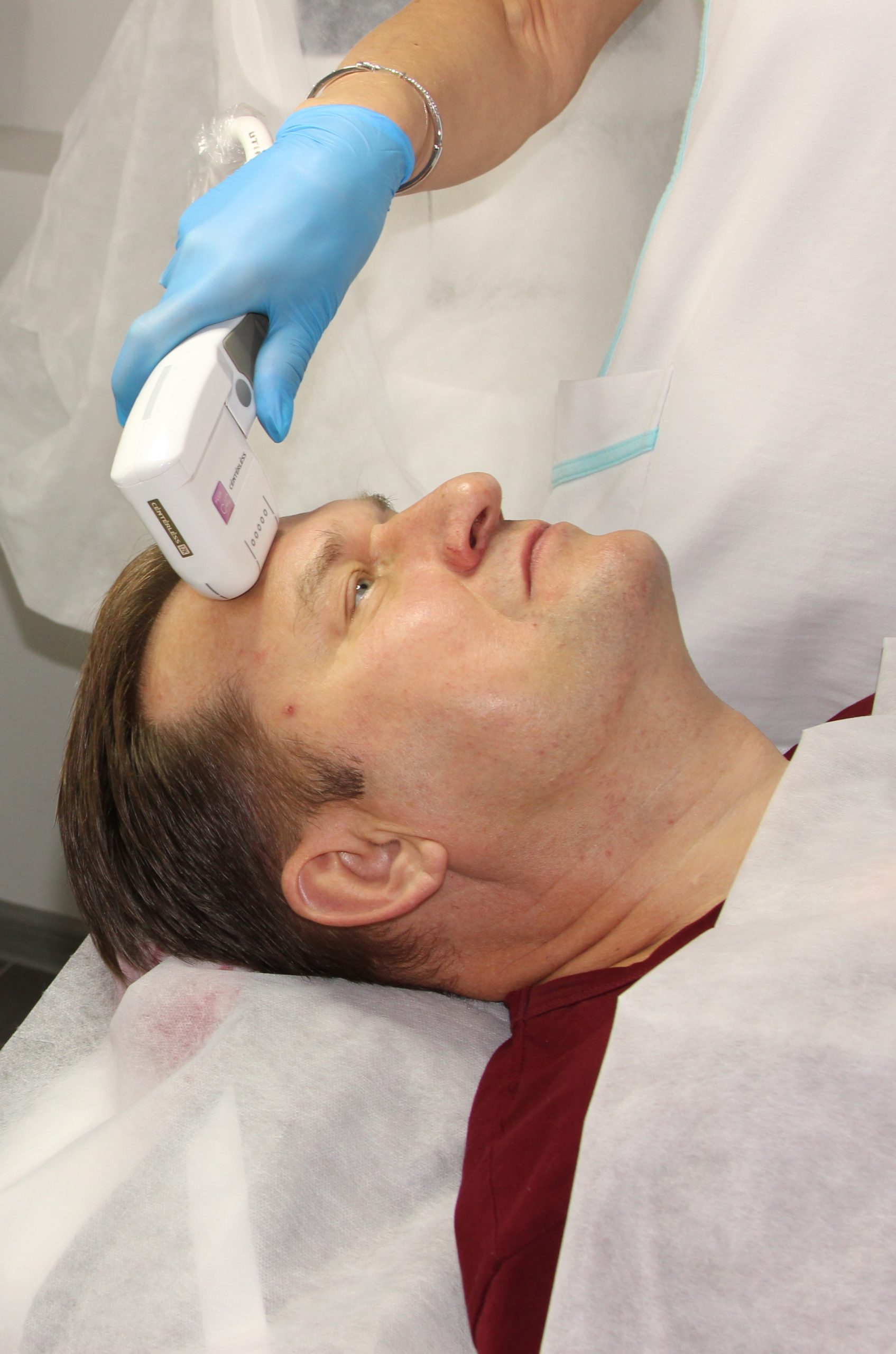 SMAS-лифтинг для мужчин SMAS-лифтинг для мужчин