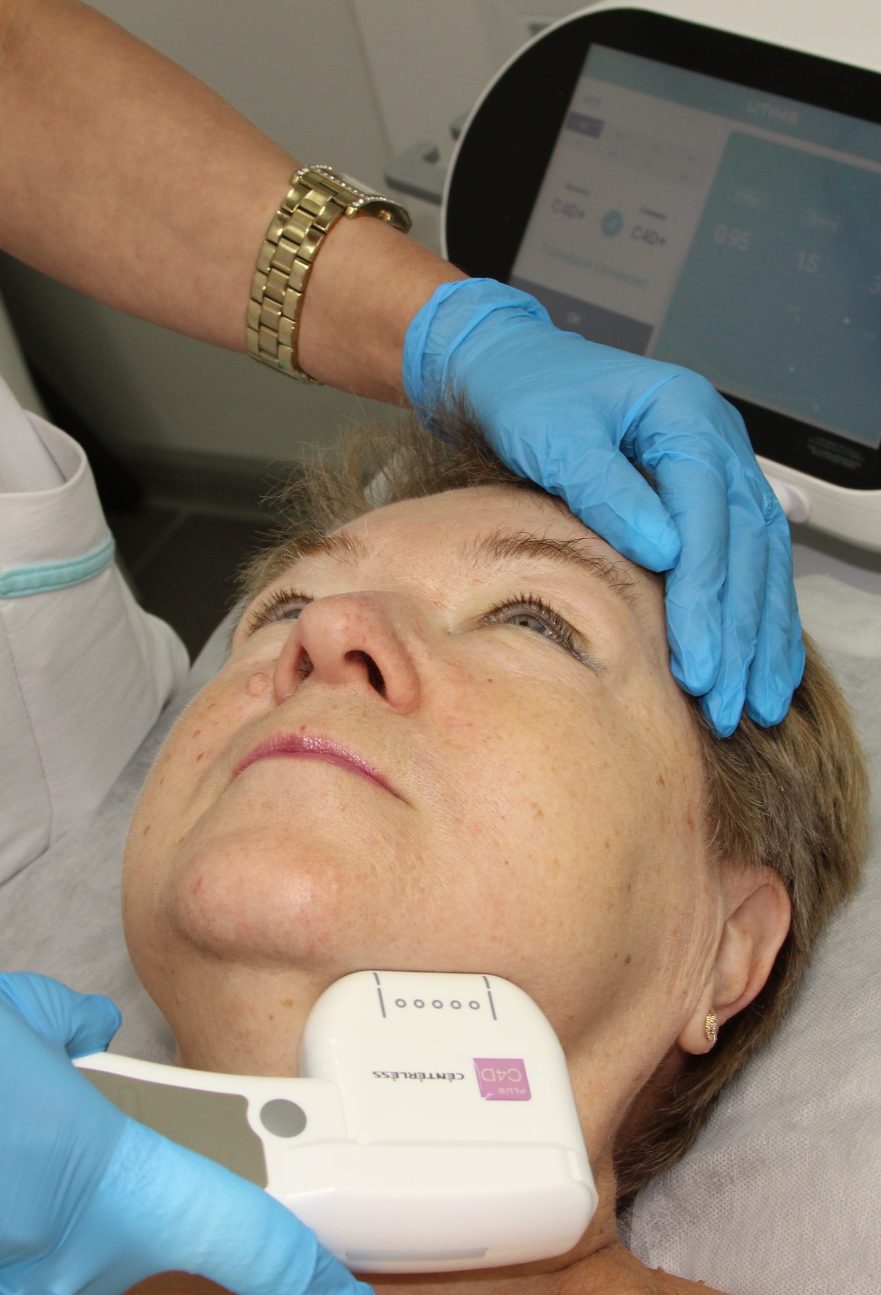 SMAS-лифтинг подбородка SMAS-лифтинг подбородка