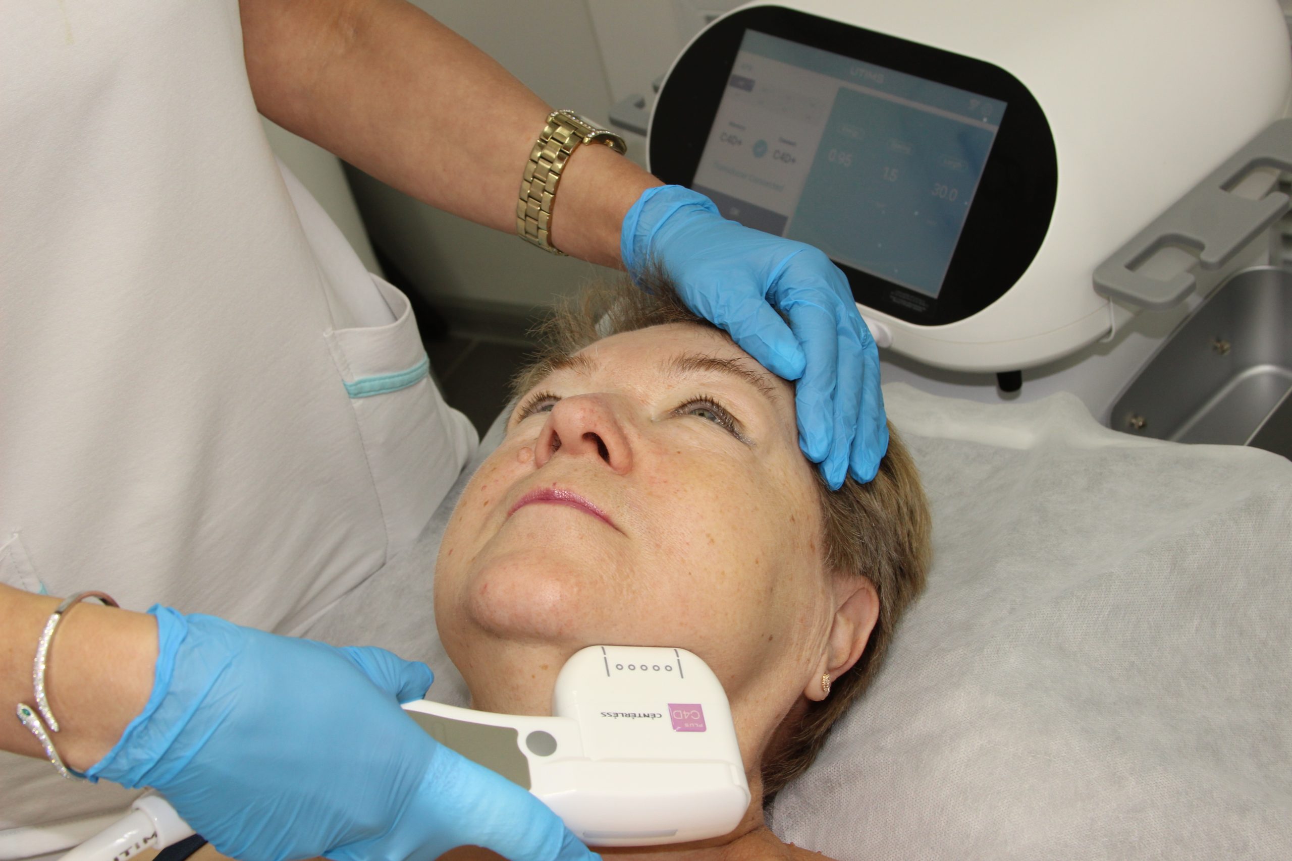 Показания к SMAS-процедуре для подбородка