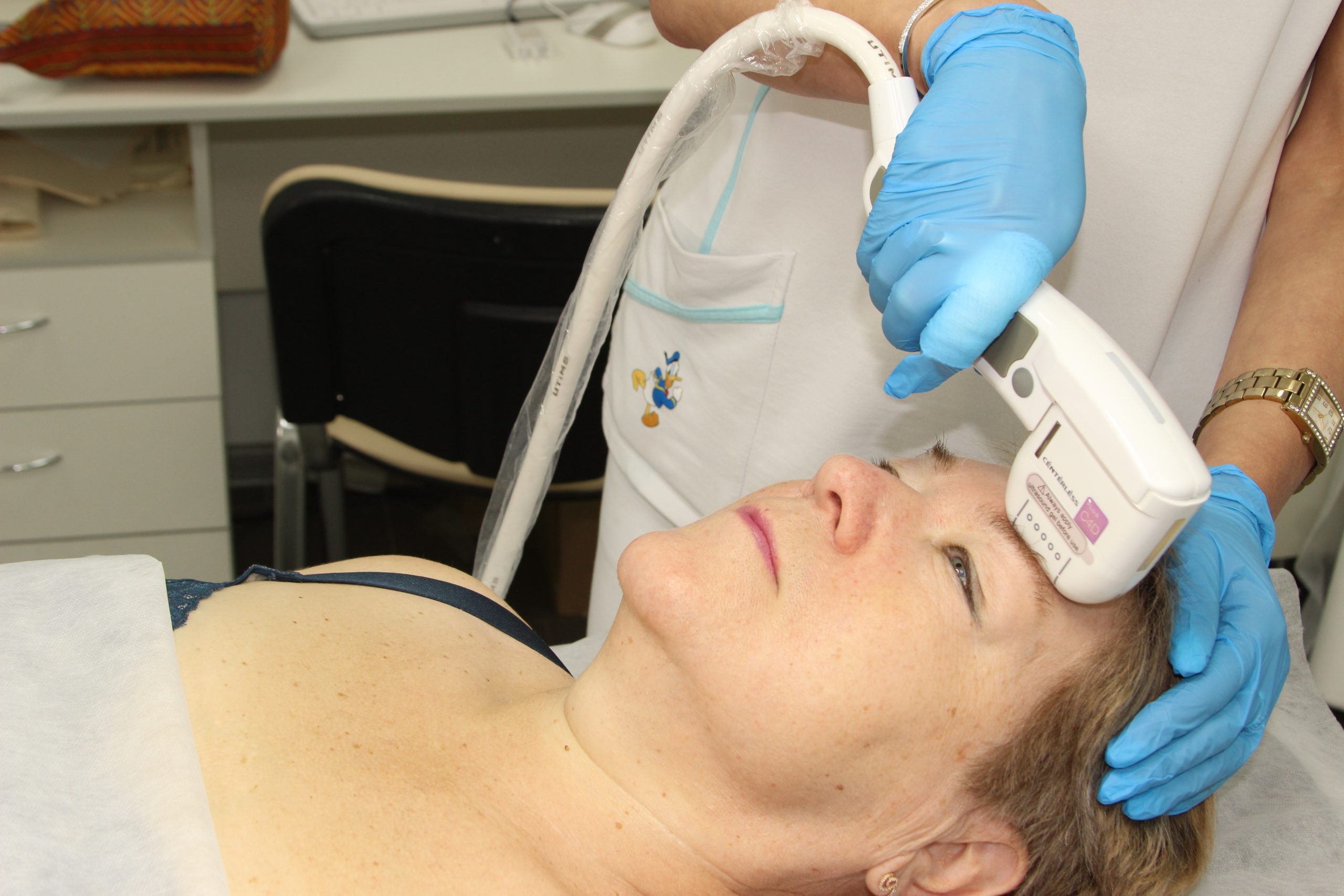 Эффект от SMAS-лифтинга лба