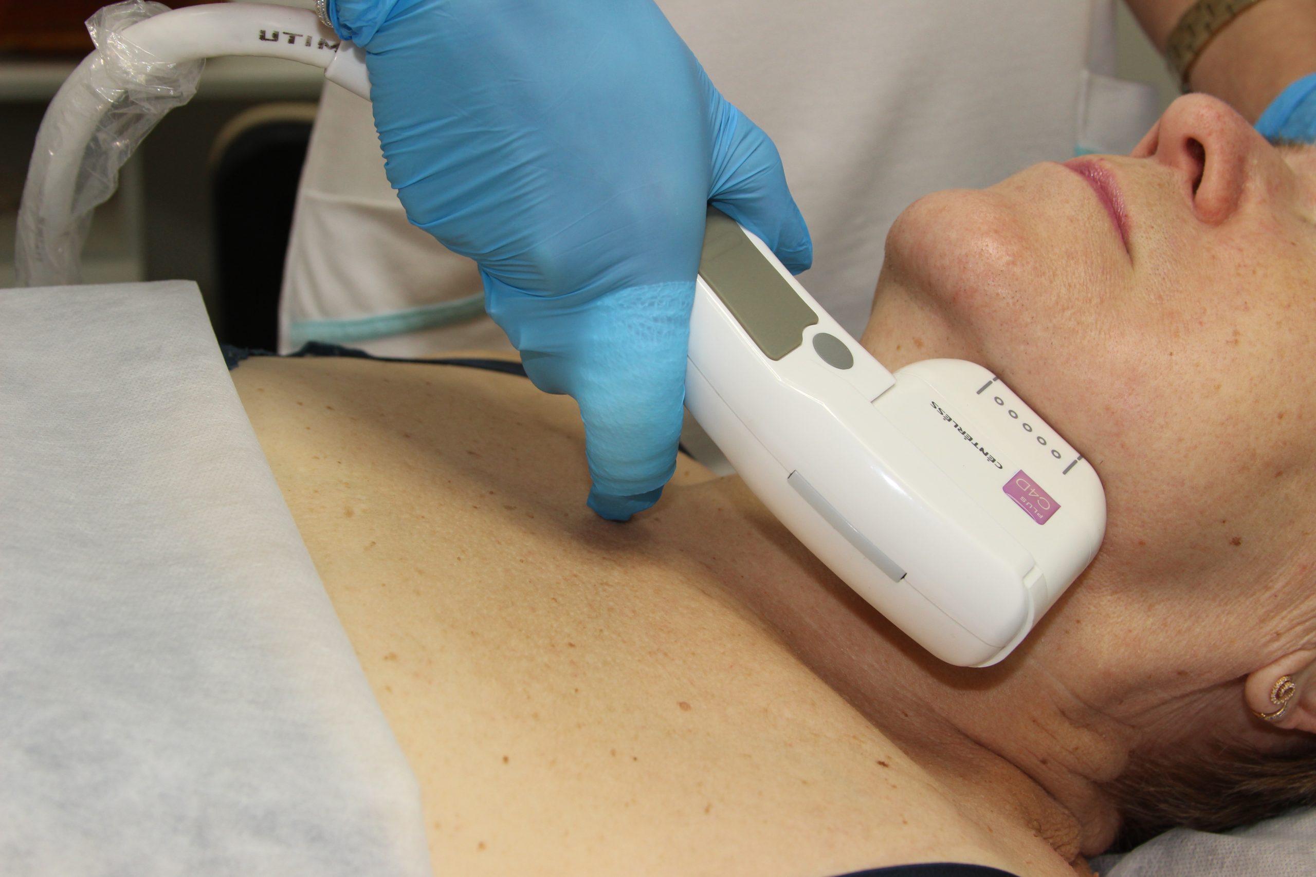 Как проходит SMAS-лифтинг брылей